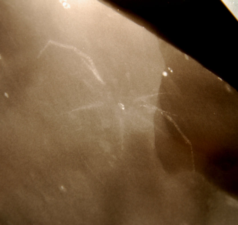 Mimetaster hexagonalis_Bundenbach_zoom